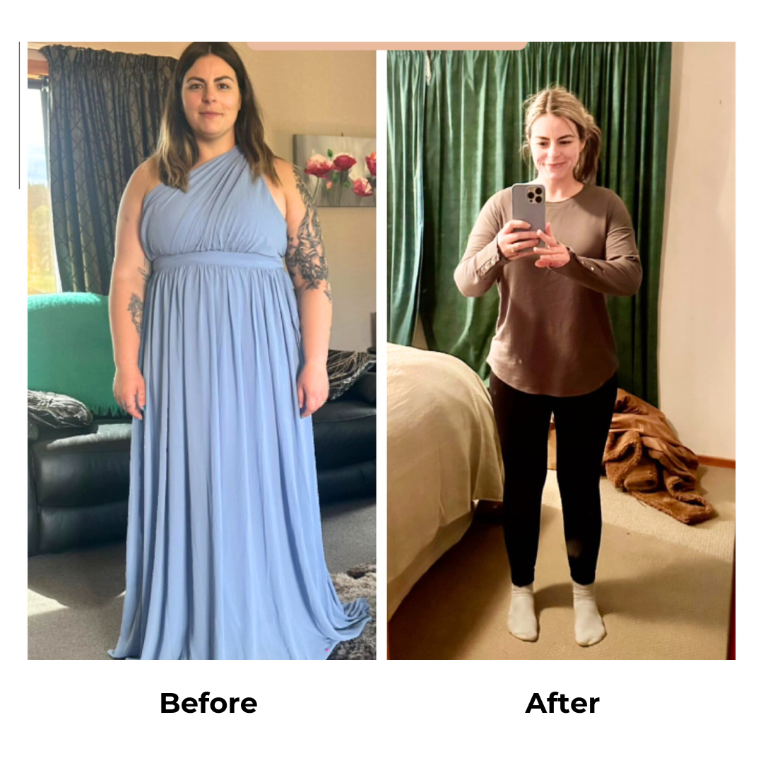 Kaylan lost 28 KG after gastric sleeve surgery in Thailand